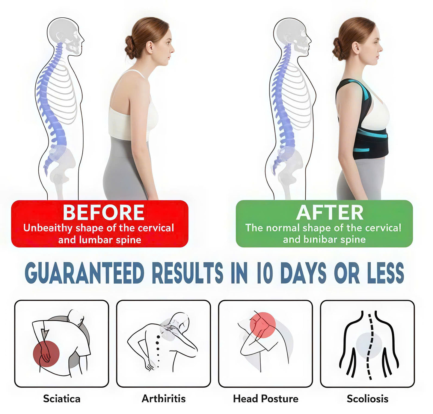 Vinebrace - Back Brace Posture Corrector for Women and Men with Natural Curve Correction Tech